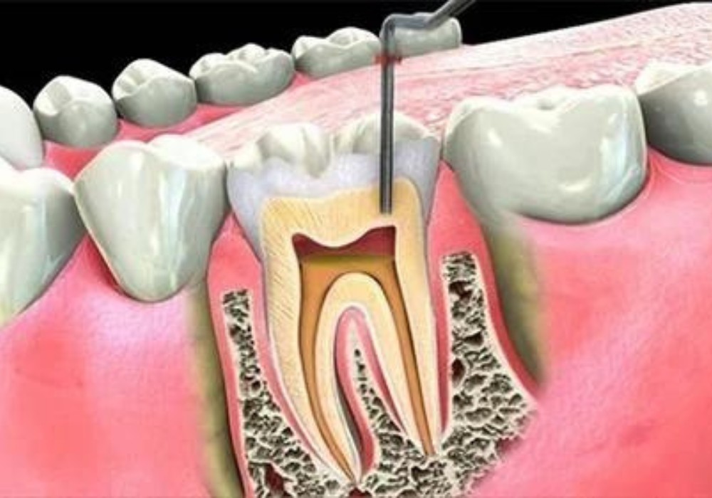 teeth dental